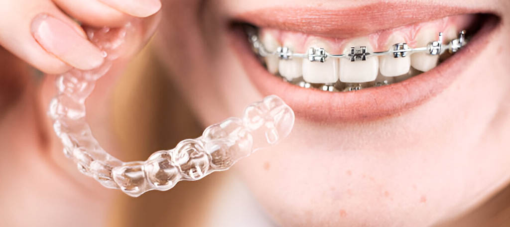 Orthodontic Treatment assam